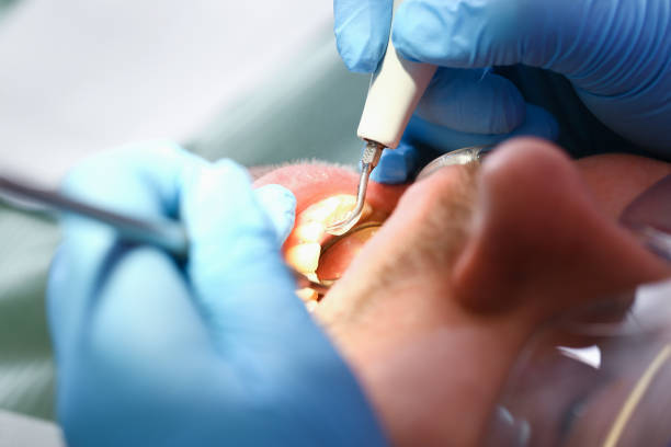 Best Emergency Treatment for Toothache in Elleale, ND