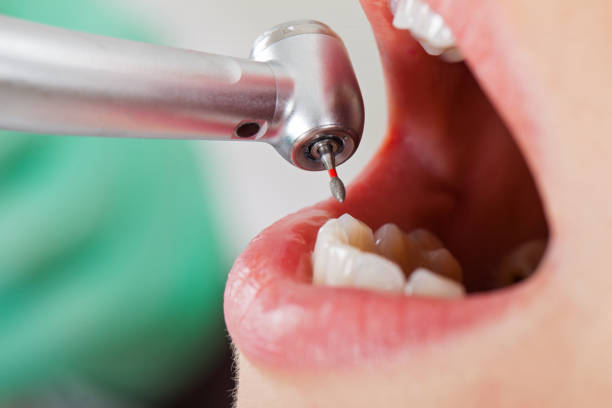 Best Weekend Emergency Dentist in Elleale, ND